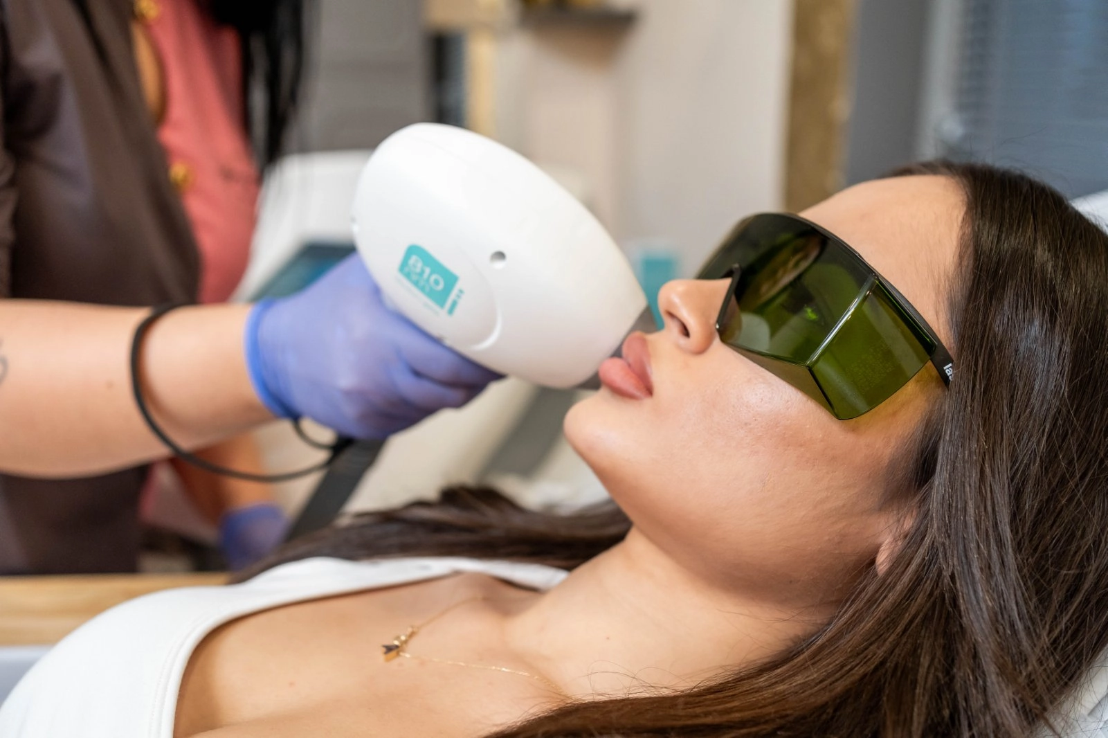 laser-epilation-image